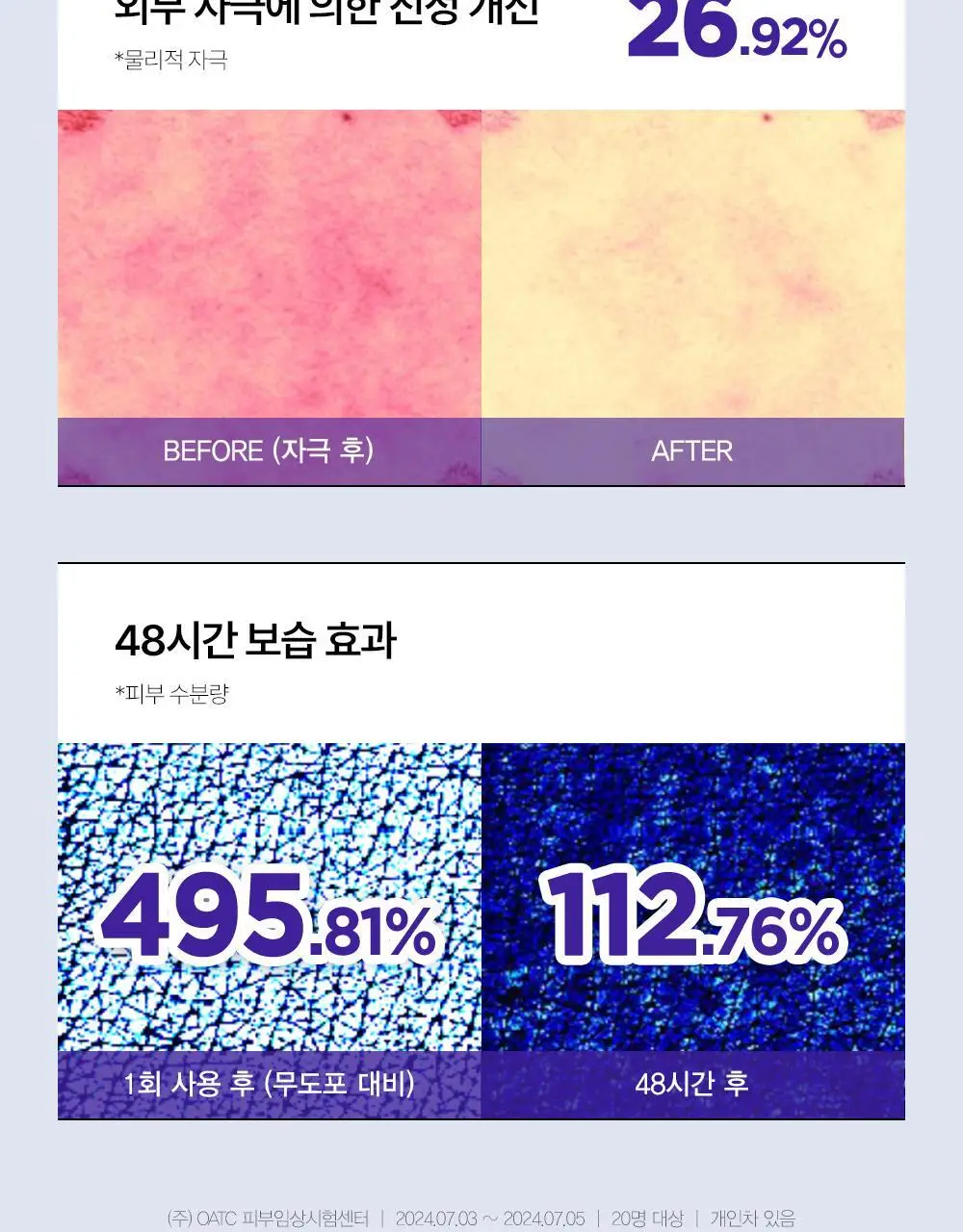 [수분/진정] 더마토리 모델링 팩 단품 2종 택1(시카/히알샷) 상세페이지 13